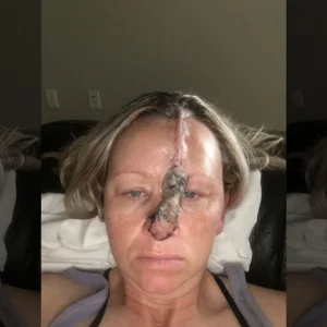 skin-cancer1.jpg
