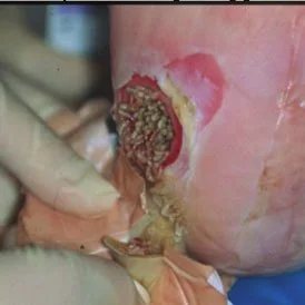 Maggots in wound.jpeg